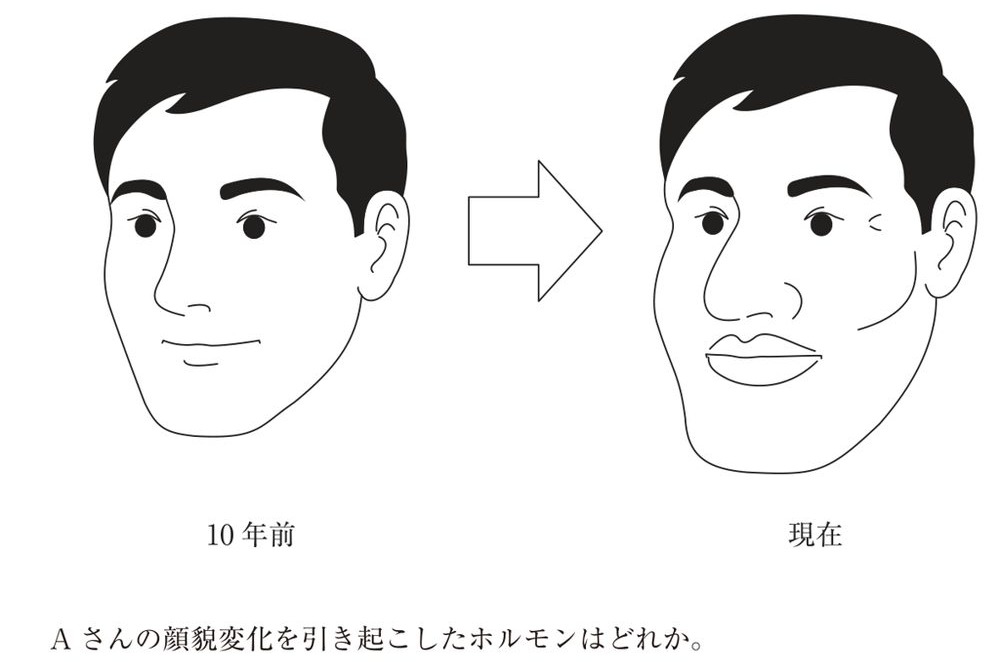 この問題の図