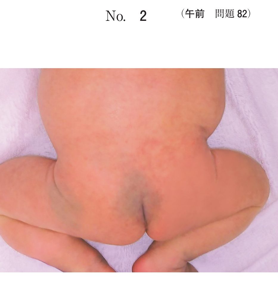 この問題の図