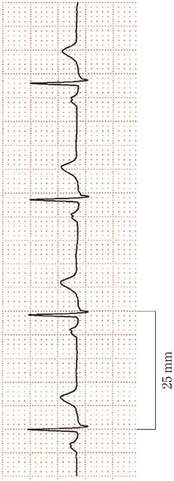 この問題の図