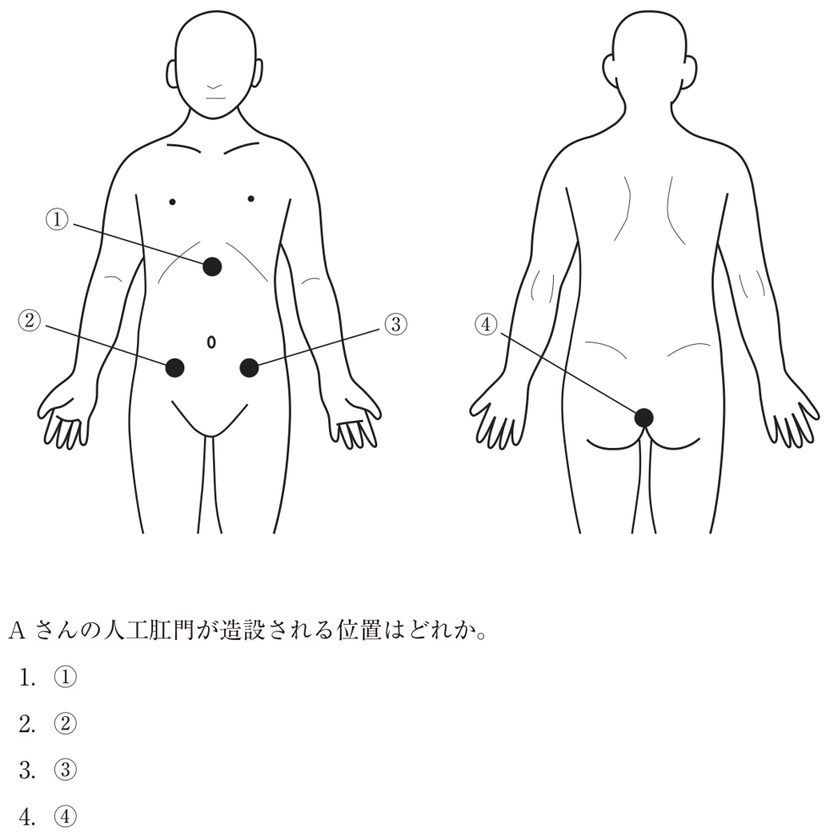 この問題の図