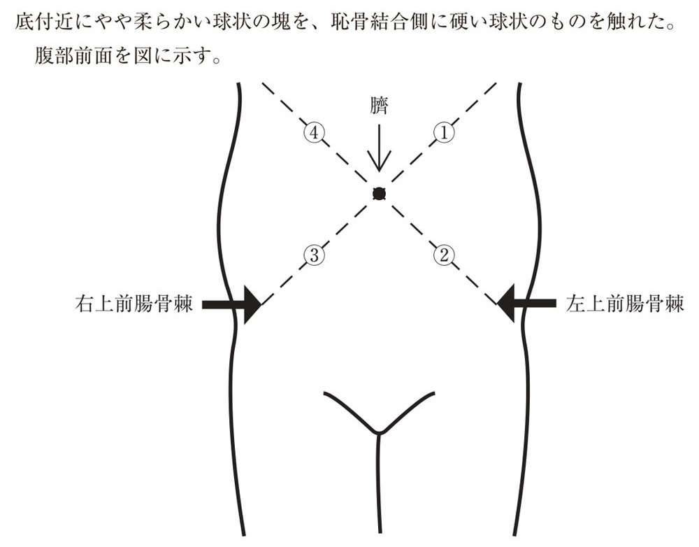 この問題の図