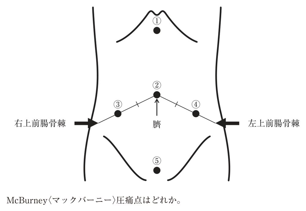 この問題の図