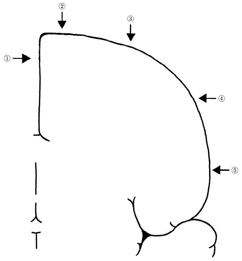 この問題の図