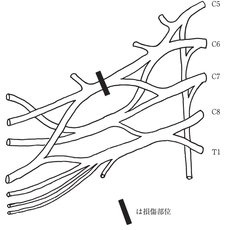 この問題の図