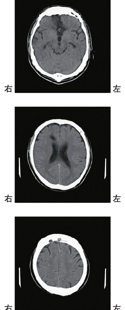 この問題の図