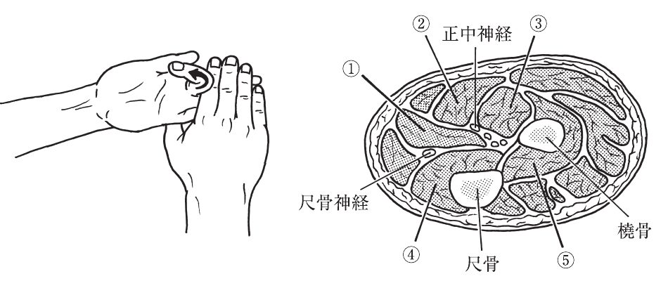 この問題の図