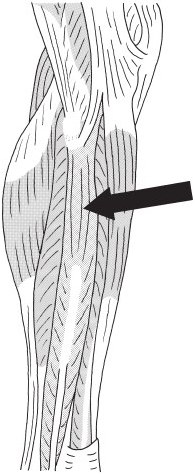 この問題の図