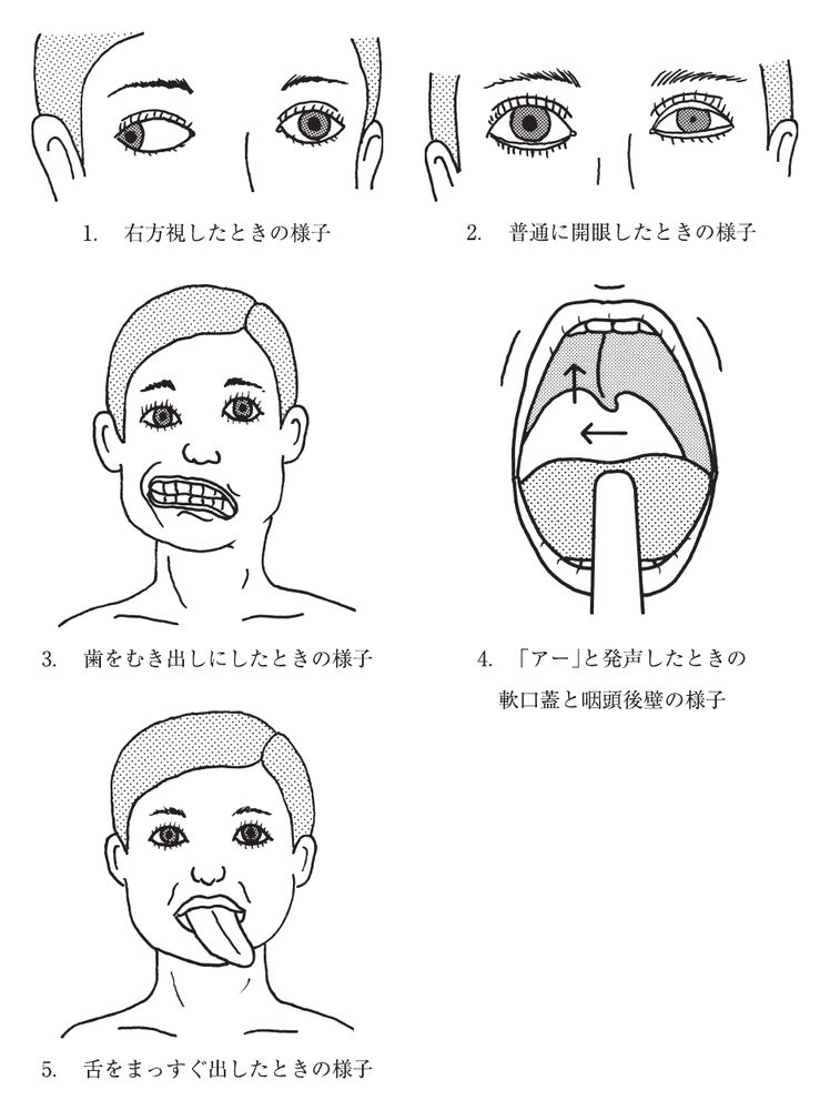 この問題の図