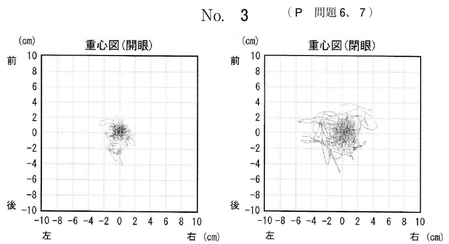 この問題の図
