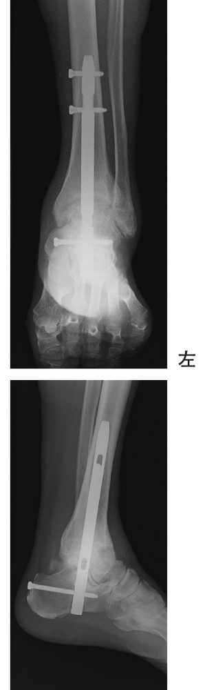 この問題の図