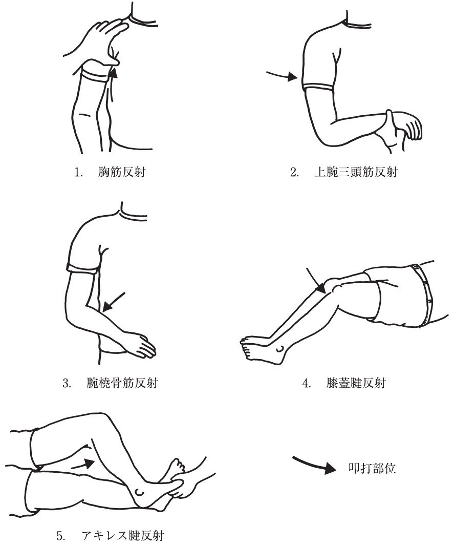この問題の図