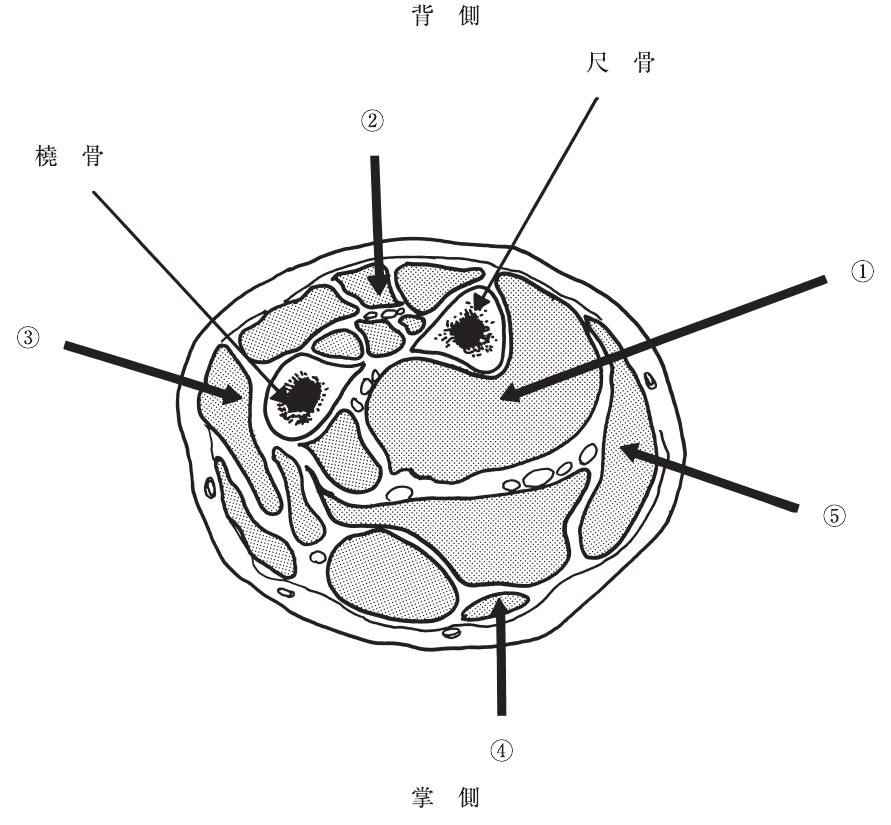 この問題の図
