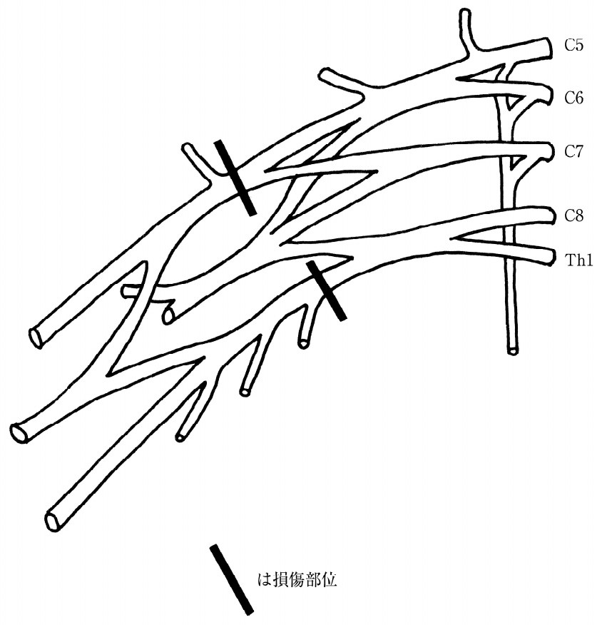 この問題の図