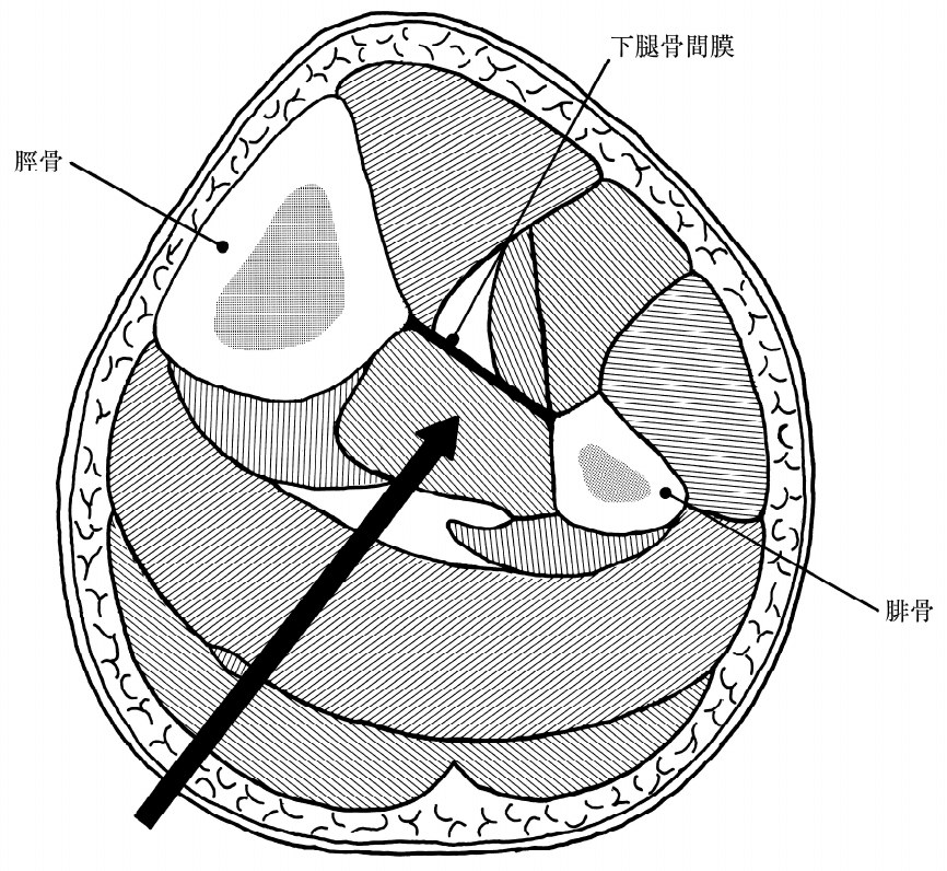 この問題の図