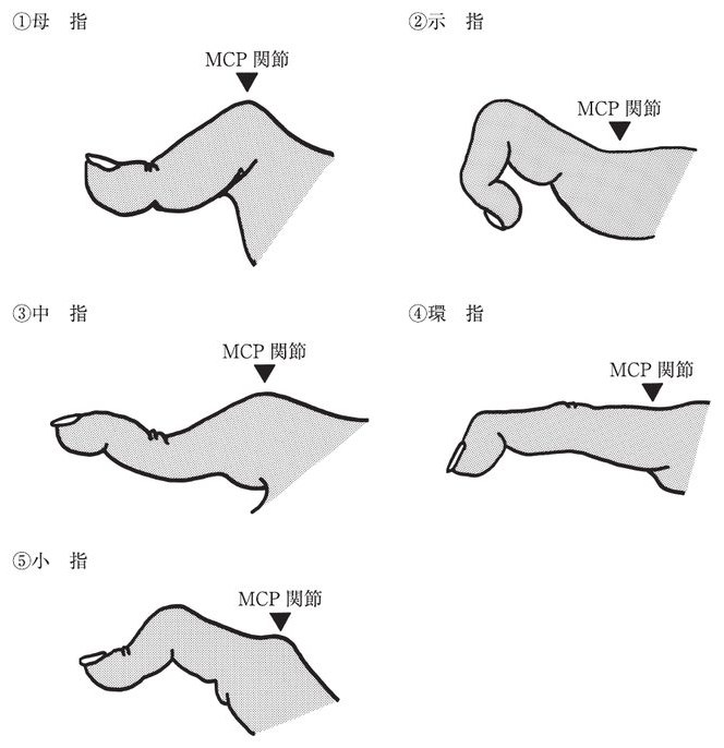 この問題の図