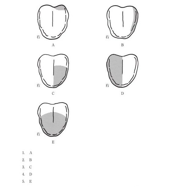 この問題の図