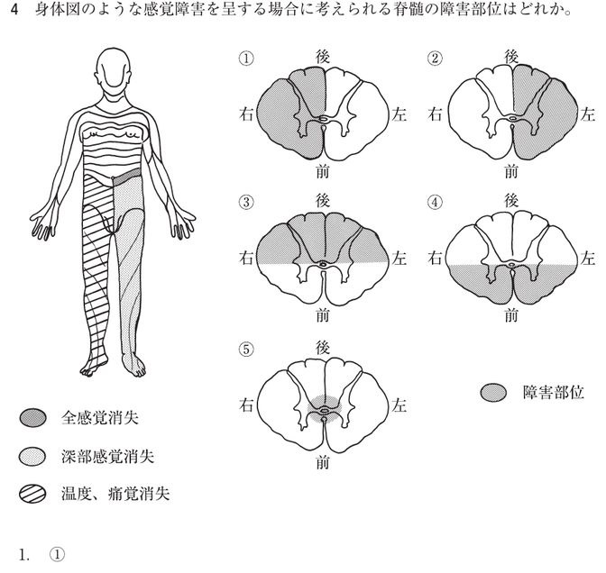この問題の図