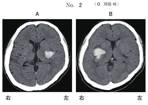この問題の図